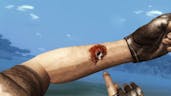 Far Cry 2 - Fixing Dislocation (Healing) 