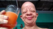 Bald guy drinks orange juice