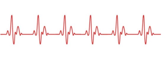 Heartbeat