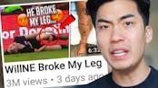 He Broke My Leg