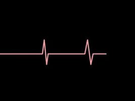 Heartbeat dying