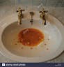 Vomit in Bathroom