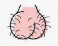 Hairy