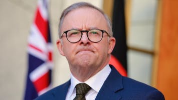 Anthony Albanese soundboard